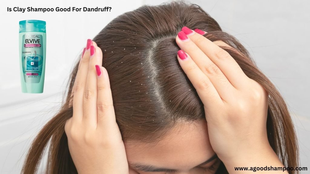 Is Clay Shampoo Good For Dandruff? Truth From a Hair Analyst 1 Is Clay Shampoo Good For Dandruff