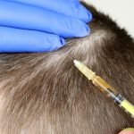 Does Good Guy Hair Regrowth Shampoo Work for Hair Growth