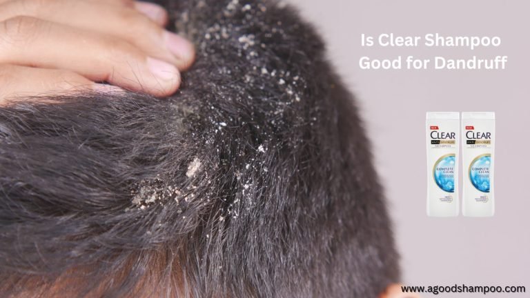 Is Clear Shampoo Good for Dandruff