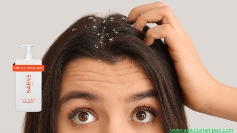 Which Native Shampoo Is Good for Dandruff? Reviews & Tips 12 Which Native Shampoo Is Good for Dandruff