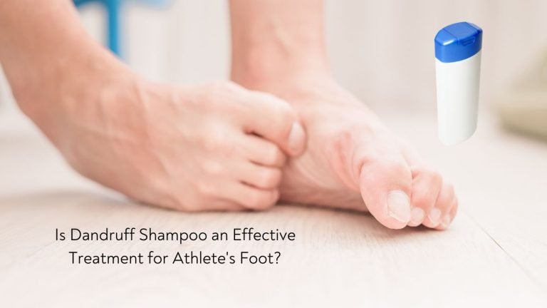 Is Dandruff Shampoo an Effective Treatment for Athletes Foot