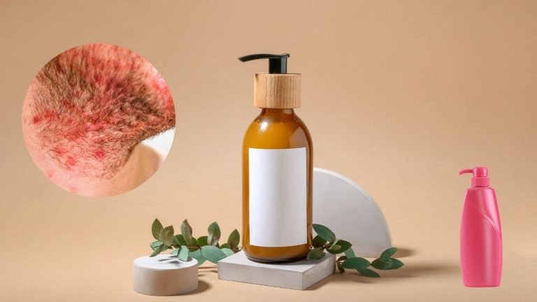 what shampoo is good for hair folliculitis