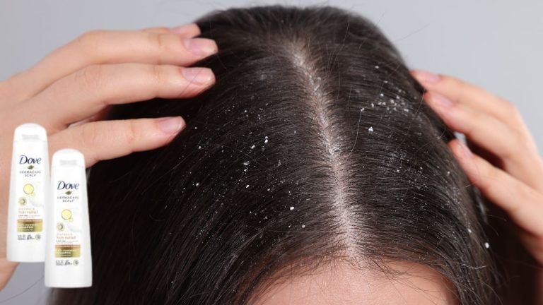 Dove Anti-Dandruff Shampoo