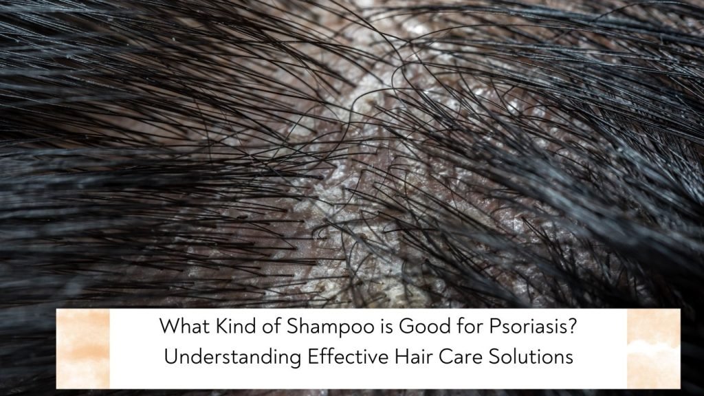 What Kind of Shampoo is Good for Psoriasis Understanding Effective Hair Care Solutions