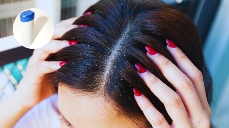 is dandruff shampoo good for hair growth