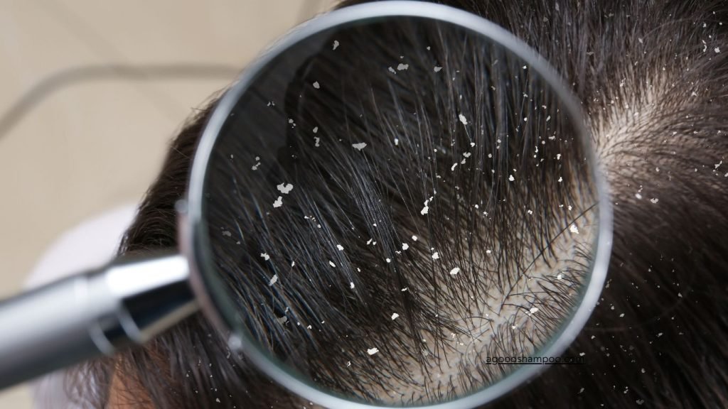 Is Hask Shampoo Good For Dandruff