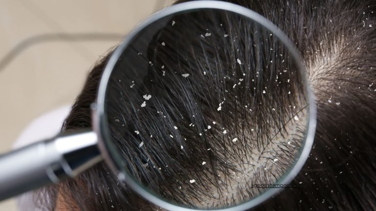 Is Hask Shampoo Good For Dandruff