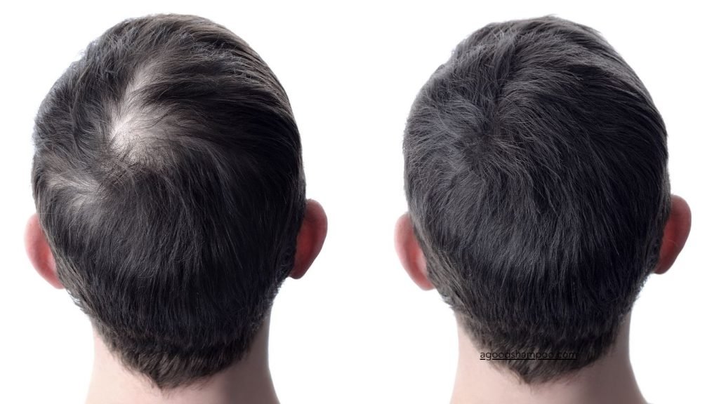 Is Thickening Shampoo Good for Hair