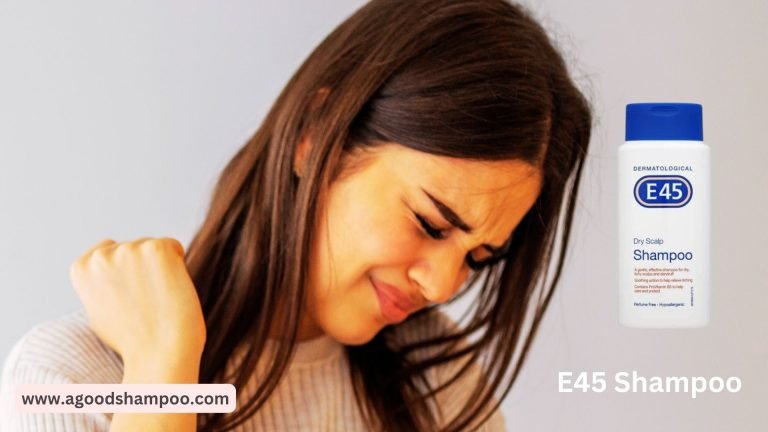 is e45 shampoo good for scalp psoriasis