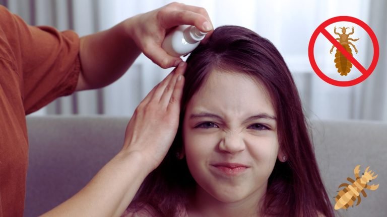 What Shampoo Is Good For Head Lice: Best Picks for Men, Women & Kids 25 What Shampoo Is Good For Head Lice