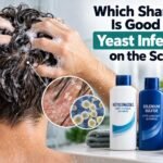 Which Shampoo Is Good for Yeast Infection on the Scalp?